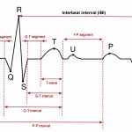 ecg